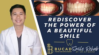 Restoring Smiles with 3D-Printed Dentures
