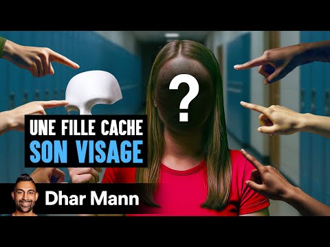 Une Fille Cache SON VISAGE À CAUSE D'une Cicatrice | Dhar Mann Studios