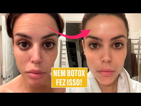 Rejuvenesci minha pele com produto de farmácia!