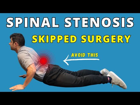 Lumbar Spinal Stenosis recovery without surgery