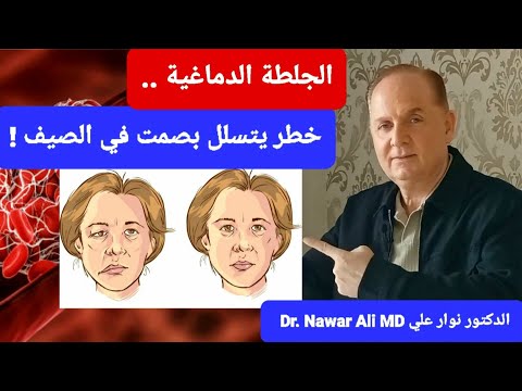 الجلطة الدماغية .. احذروا هذا العدو الخطير يزداد ويتسلل إليكم بصمت في الصيف !