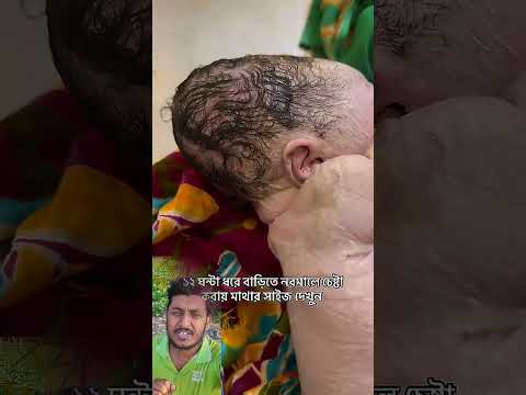 সবাই সতর্ক হোন এ ধরনের ভুল কখনো করবেন না #baby #trending #cute #shorts #cutebaby #shortvideo #sad