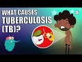 Tuberculosis Awareness and Knowledge Assessment