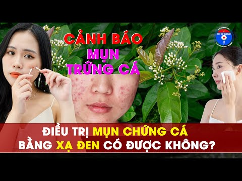 Tác dụng thực sự của Xạ Đen với mụn Trứng Cá?
