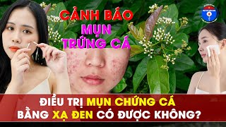 Tác dụng thực sự của Xạ Đen với mụn Trứng Cá?
