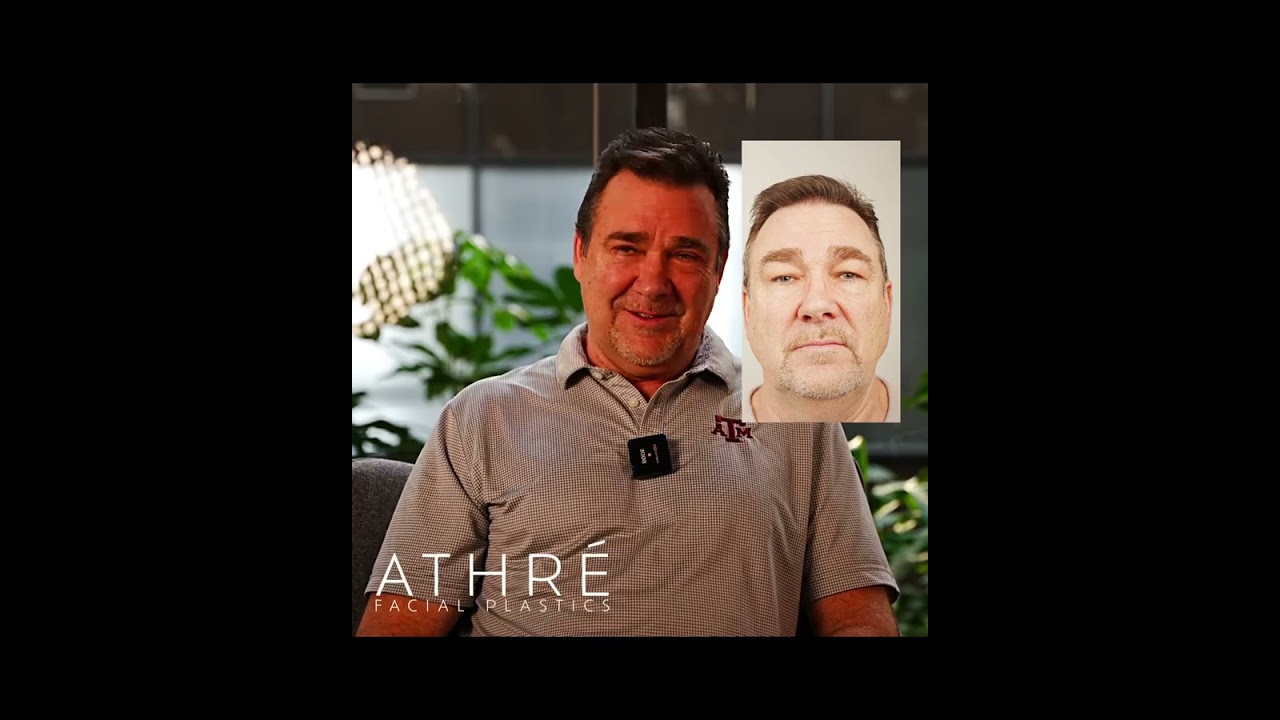 Man showcasing facial changes after treatment.
