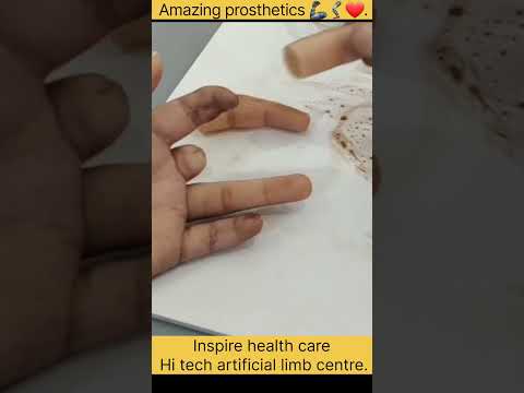 सबसे अच्छे कृत्रिम अंग यहां बनते हैं। #inspirehealthcare #artificiallimbs #inspire #hitech #shorts