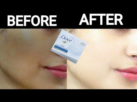 Dove soap for skin whitening cream | Dove white beauty Bar whitens skin | Skin whitening remedies