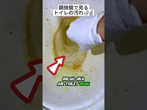 Apa Itu Didalam Air Toilet😱