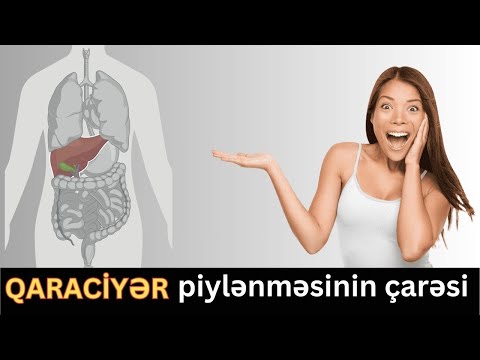 Qaraciyər piylənməsini anında aradan qaldıracaq!