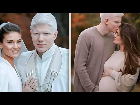 Ken Je de Albino Die Een Baby Ter Wereld Brengt? Je Gelooft Niet Hoe Het Kind Er Nu Uitziet!