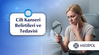 Cilt Kanseri Belirtileri ve Tedavisi
