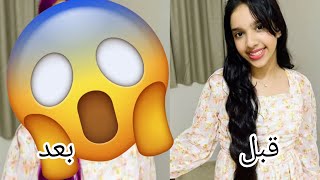 غيرت شكل شفا 😱مارح تتوقعوا كيف صارت 🩷