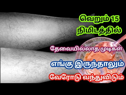 நிரந்தரமாக வேண்டாத முடிகள் கொட்டிவிடும் | unwanted hair removal at home in tamil