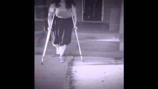 Sandra's broken ankle and knee scooter