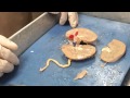Kidney Structure and Function