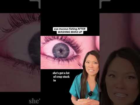 Eye Fishing