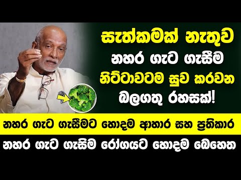 කිසිම සැත්කමක් නැතුව නහර ගැට ගැසීම නිට්ටාවටම සුව කරවන රහසක්! | නහර ගැට ගැසීමට ආයුර්වේද ප්‍රතිකාර