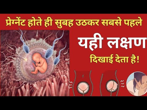 अगर 10 वे दिन से 5 लक्षण दिखने लगा तो 100% प्रेग्नेंसी रुक गयी है। Early pregnancy symptoms।