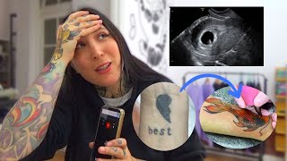 Valorarte, perdida gestacional y consejos para cover up