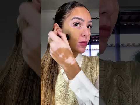 Mujer con vitíligo transforma su piel con maquillaje 💄✨