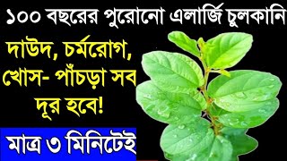 এলার্জি, চুলকানি, দাউদ যতোই পুরোনো হোক ভালো হবে মাত্র ৩ মিনিটেই || রক্তে মিশে থাকা এলার্জিও দূর!