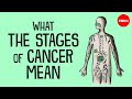 Understanding Cancer Staging