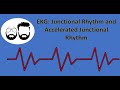 Junctional Rhythm Characteristics and Functions