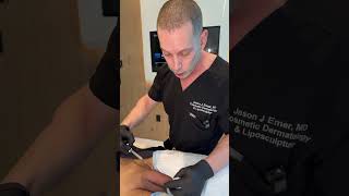 Penile Filler 101: How It Works, What to Expect, and Who It’s For l Dr. Jason Emer