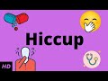 Understanding Hiccups and Their Treatments