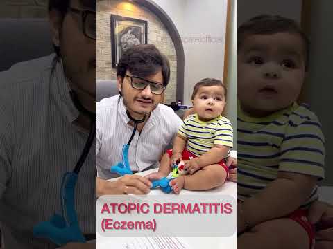 Atopic dermatitis #drimranpatel #baby #shorts #doctor