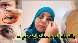 كتعاني من سواد تحت العين انتفاخ العين وتجاعيد تحث العين مع هاد الوصفة غادي تهناي منهم👍👇👇🤩