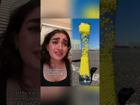 I got BIT A DAY BEFORE MY BIRTHDAYπΒ #OWΒ #BIRTHDAY