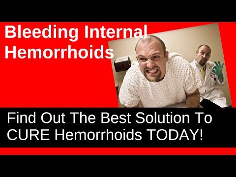 Bleeding Internal Hemorrhoids - How To Stop It!