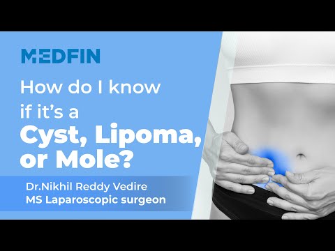 Cyst, Lipoma & Mole: What’s the Difference?