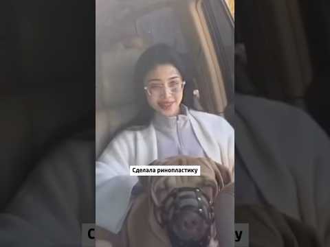 Сделала ринопластику и получила повреждение мозга