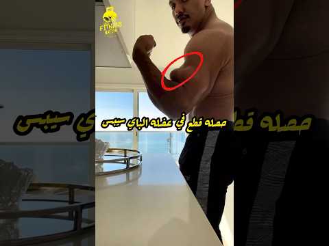 المجنون larrywheels حصله اصابة قطع في عضله الباي سيبس بسبب جنونة في الأوزان 🫣