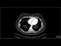 Anatomy and Physiology of the Abdomen