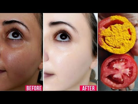1 बार लगाके देखो चेहरे को ऐसा गोरा चमकदार बना देगा ये | Tomato Scrub for Bright Glowing Skin