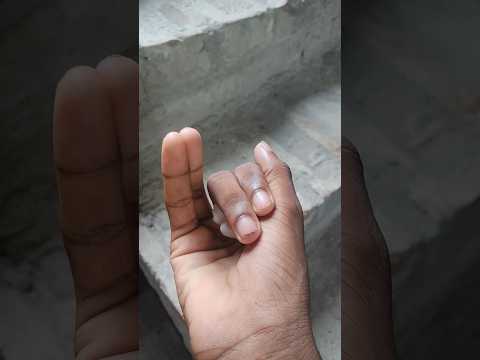 SUPER cute insects#anyuniqueanimals#animals #insects #bug #caterpillar#mantis#529