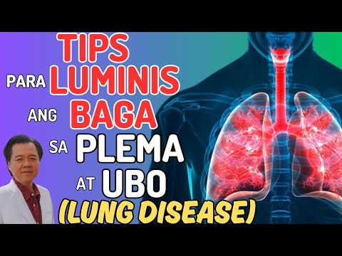 Tips Para Luminis ang Baga sa Plema at Ubo (Lung Disease). - By Doc Willie Ong
