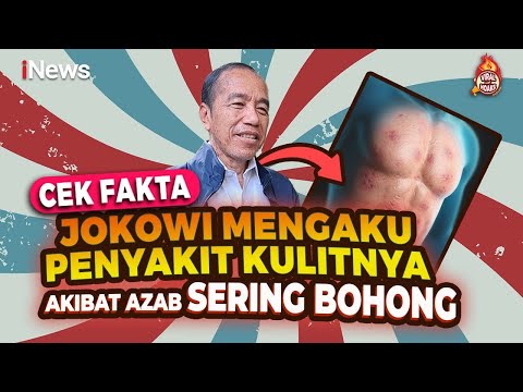 [FULL] Apa Benar Jokowi Mengaku Penyakit Kulitnya Akibat Azab Sering Bohong? Cek Fakta