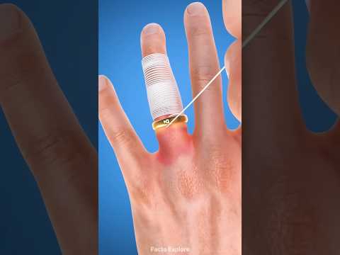 What happens if the ring gets stuck on your finger 🤞#shortvideo