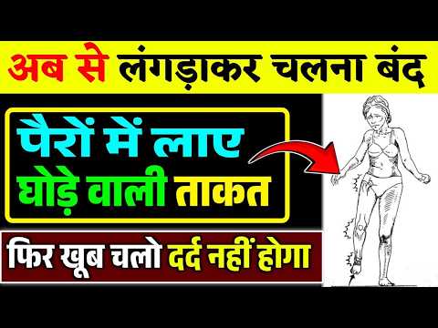 गठिया में लंगड़ाकर चलना बंद करें वरना होगी सर्जरी|Hip And Knee Strengthening Exercises|Knee Pain