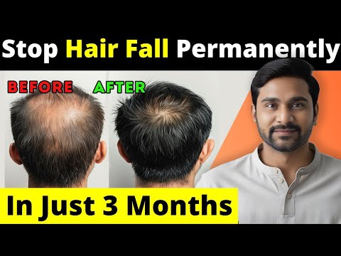 बाल झड़ना रोकें, नए बाल उगाएं सिर्फ 90 दिनों में | Hair Growth Tips | Hair Fall Solution At Home