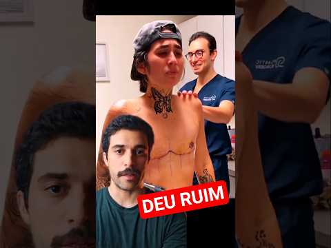 O Resultado Curioso da Cirurgia Similar à cirurgia de Ginecomastia