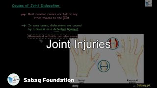Joint Injuries