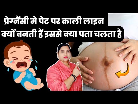 प्रेग्नैंसी मे पेट पर काली लाइन क्यो बनती है इससे क्या पता चलता है|Linea nigra during the pregnancy|