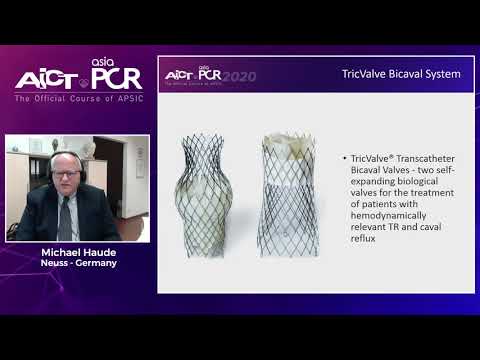 New horizons in tricuspid therapy – The tricvalve solution – AICT-AsiaPCR 2020