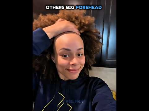 Others big forehead vs this one #trollface #edit #troll #fyp #usa #trollface